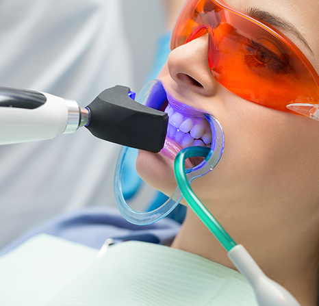 Woman receiving ultraviolet light treatment on her teeth.